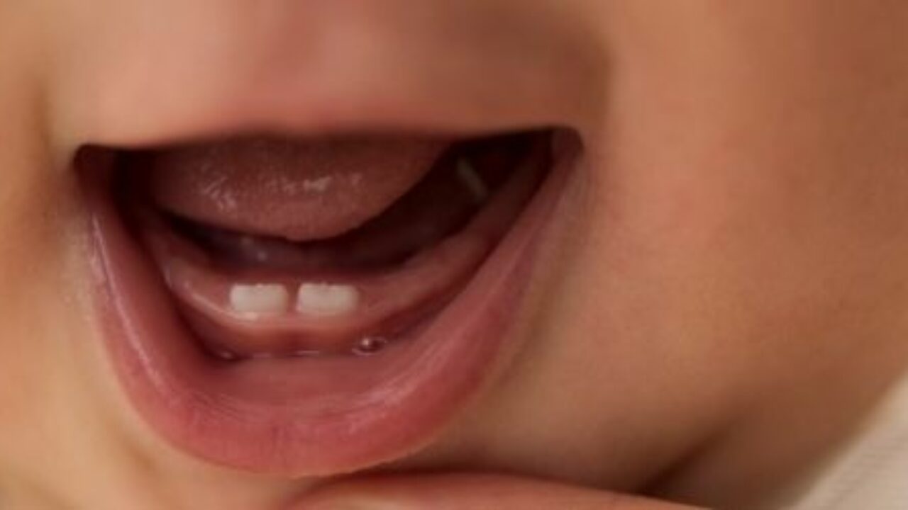 Dents De Lait