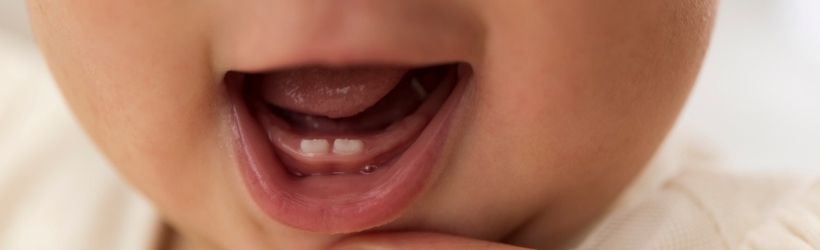 Âge dent bébé : quelles dents à quel âge ? poussée dentaire - Dent