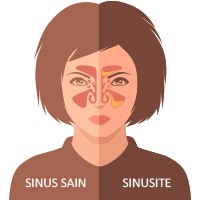 Sinus : définition 