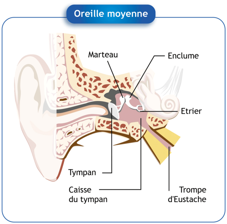 Hyperacousie définition, symptômes, diagnostic et traitements
