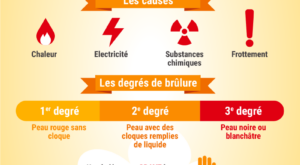 Infographie-brulure-01