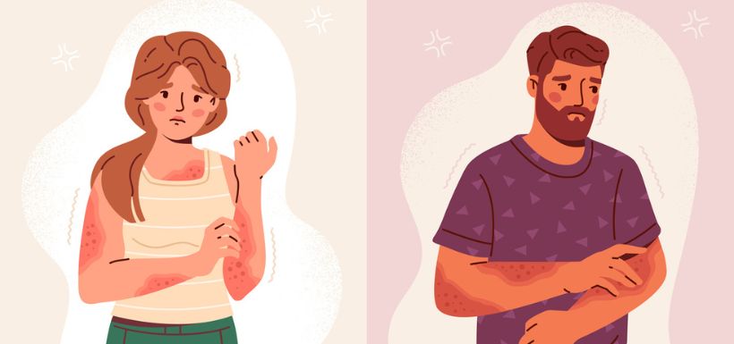 header pour article sur la dermatillomanie - homme et femme qui se gratte, avec des marques sur leur peau