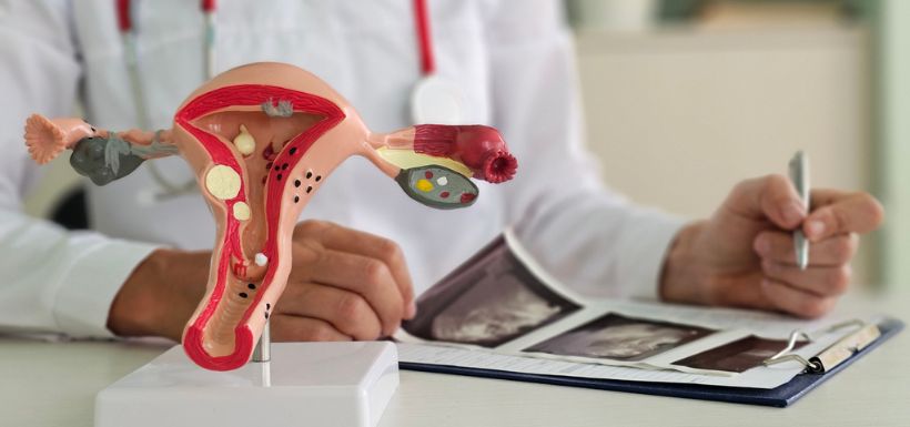 examen endométriose