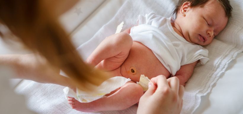 image bébé article "Soins du cordon ombilical : que faire (et ne pas faire) ?"