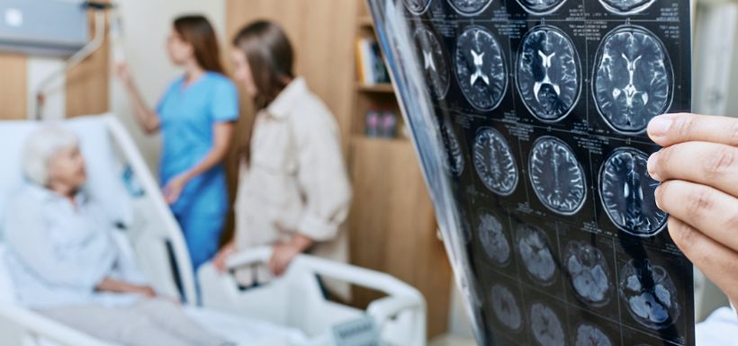header article "Hémisphère de départ des symptômes moteurs de la Maladie de Parkinson : quelle influence ?"
