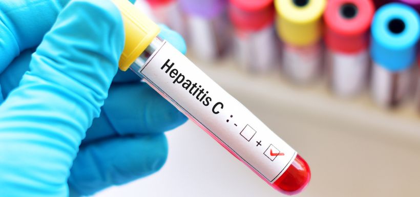 dépistage hépatite C