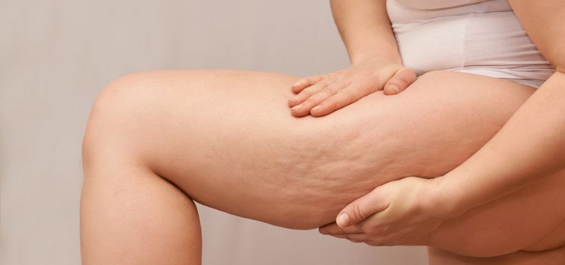 header article cellulite femmes et conseils