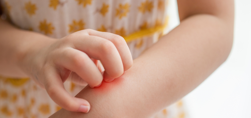 Éruption-cutanée_Enfant_Médicament Eruption-cutanee_Enfant_Medicament.